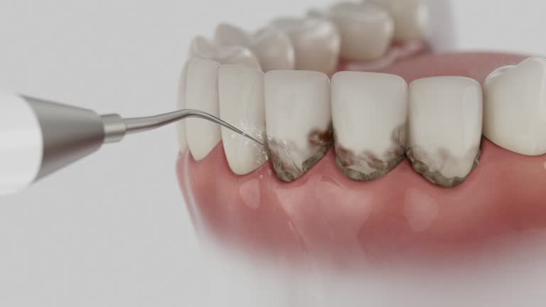 Trusted Emergency Dentist service in Chillicothe, OH - Dentist Open Now